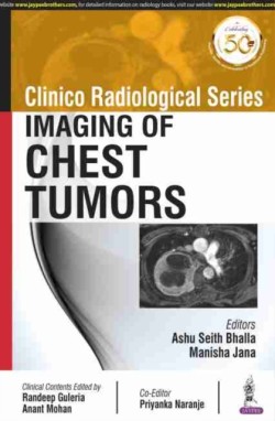 Clinico Radiological Series: Imaging of Chest Tumors