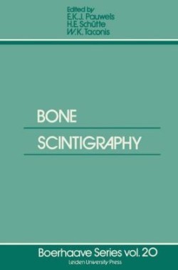 Bone Scintigraphy