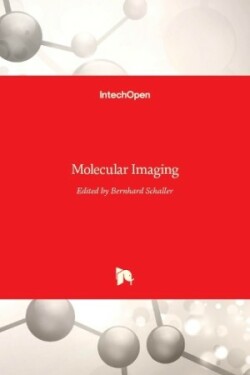 Molecular Imaging