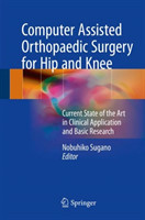 Computer Assisted Orthopaedic Surgery for Hip and Knee Current State of the Art in Clinical Applicat