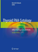 Thyroid FNA Cytology Differential Diagnoses and Pitfalls