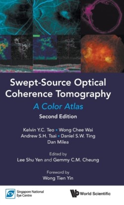  Swept-Source Optical Coherence Tomography 