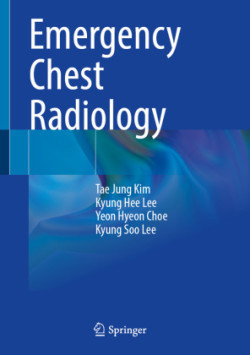 Emergency Chest Radiology