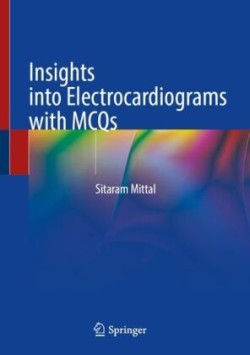 Insights into Electrocardiograms with MCQs
