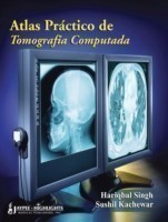 Atlas Práctico de Tomografia Computada