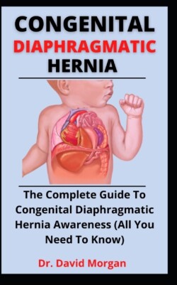 Congenital Diaphragmatic Hernia