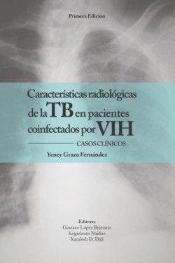 Características radiológicas de la TB en pacientes coinfectados por VIH. CASOS CLINICOS