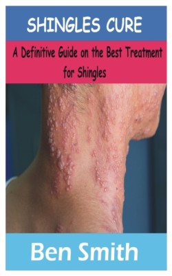 Shingles Cure