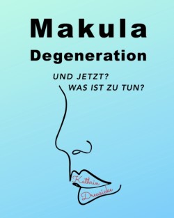 Makuladegeneration
